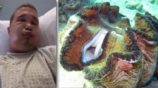 เล่นแผลงๆ นักดำน้ำหนุ่ม เห็นหอยมือเสืออ้าใต้ทะเล ควักจู๋แหย่โดนหนีบ หามส่งรพ.แทบไม่ทัน