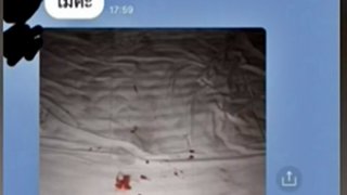 เลือดกระจายเต็มเตียง!! หมอฟันเตือน สาวจัดฟันทำออรัลเซ็กส์แฟนหนุ่ม เหล็กจัดฟันพลาดเกี่ยวของรัก เจ็บเลือดพุ่ง