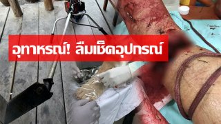 อุทาหรณ์! ลืมเช็คอุปกรณ์ เครื่องตัดหญ้า &ldquo;ตัดขาขาด&rdquo; เป็นภาพที่สยองมาก&hellip;