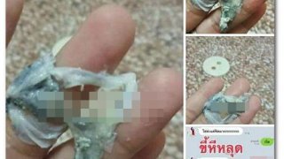 เพจดังเตือน!! ยาสมุนไพรสอดจิ๋มเพื่อรีแพร์ ดีทอกซ์ มีสิ่งที่หลุดออกมา มันจะเป็นตกขาว มากกว่า