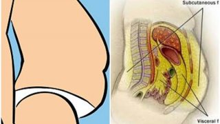 เตือน! พุงโต เสี่ยงตายเร็ว รีบแก้ไขก่อนสายเกินไป