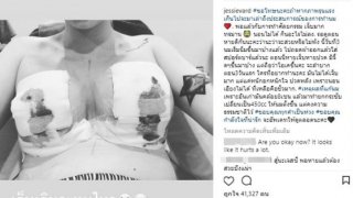 สาวลูกครึ่ว!!&rsquo;ผ่าแก้นมใหม่-ของเก่าคล้อย8ซม. ย้อนเวลาได้จะไม่ทำ