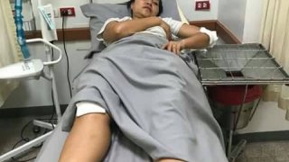 คนดังโดนบ่อย!! สุนารี ราชสีมา ถูกหมาที่บ้านกัดเหวอะเย็บ 15 เข็ม หลังเข้าห้ามขณะหมากัดกัน