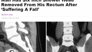 ไม่ได้ลื่นเข้ารูตูดนะ?!?! มันคือการทำแท้ง ของชาวสีม่วง??