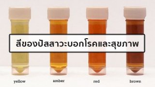 สีของปัสสาวะแต่ละสีบ่งบอกโรคที่ต่างกัน !