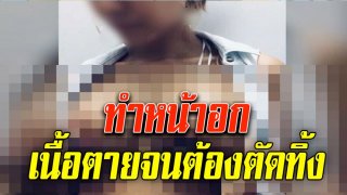 เตือนภัย สาวทำหน้าอก เนื้อตายจนต้องตัดทิ้ง