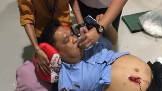 กระจกใสเกินเหตุ! หนุ่มใหญ่เดินชนกระจกธนาคารแตกกระจาย! ได้รับบาดเจ็บ!