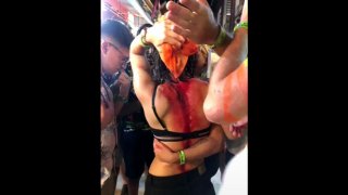 ไม่ง้อลูกค้า!! เกย์โหดใช้ขวดตีหัวผู้หญิงฝรั่งเลือดอาบ อ้างยืนบังหน้าร้าน