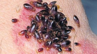 ขนหัวลุก!!! แมลงร้าย มีหมดแม้ห้องสะอาด "วิธีกำจัดถอนรากถอนโคน" จบปัญหาคันยุบยิบตอนตื่น