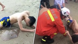 หนุ่มถูก "เงี่ยงปลากระเบน" เกี่ยวน้องชาย พิษแรงแสนเจ็บปวด...