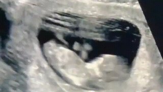 แทบกลั้นน้ำตาไม่อยู่ &ldquo;อุ้ม ลักขณา&rdquo; เมื่อเห็นหน้าลูกครั้งแรก