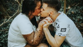 รักแท้มีอยู่จริง!! ถ้ารูปลักษณ์ฉันเป็นแบบนี้ คุณจะรักฉันไหม กับเรื่องราวความรักของ karine และ edmilson