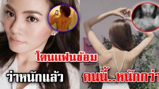8 อันดับ ดาราสาว ที่ &ldquo;โดนแฟนซ้อม&rdquo; หนักที่สุด น่าสงสารจริงๆ