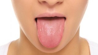 เชื้อราในช่องปาก