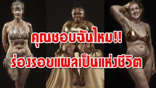 คุณชอบฉันไหม!! กับสวยงามของร่องรอยแผลเป็นแห่งชีวิต