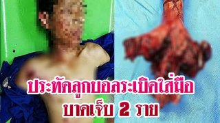 ประทัดลูกบอลระเบิดใส่มือบาดเจ็บ 2 ราย