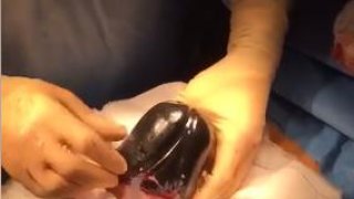 คนไข้หนุ่ม"ผ่าตัดฉุกเฉิน"หลังยัด"เซ็กซ์ทอย" "ขนาดใหญ่"เข้าไปในร่างกาย แล้วเอาออกไม่ได้ หมอลั่น"ใหญ่กว่าแขนคน"