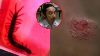 ตะขาบกัด "อัณฑะ" กลางห้างไม่ใช่เรื่องเล็ก! อาจารย์มหาวิทยาลัย เผยภาพสุดทรมาน วอนห้างดังรับผิดชอบ