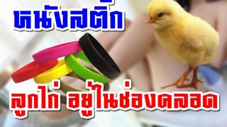 หมออึ้ง!! เจอลูกเจี๊ยบ!! หนังสติ้กเป็นสิบเส้น อยู่ภายในช่องคลอด คนไข้