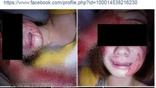 สลดใจ!! เตือนสติน้องๆที่กำลังอกหักรักคุด คิดทำร้ายตัวเอง