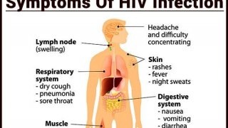 อาการของผู้ที่ติดเชื้อเอชไอวีเป็นอย่างไร