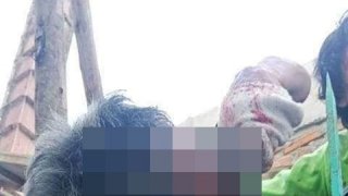 หนุ่มใหญ่พลาด..พลัดจากที่สูง เหล็กรั้วเสียบขมับ