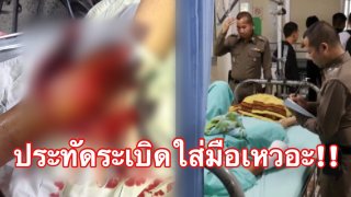 เตือนก็ไม่ฟัง!! เด็กวัย 15 ประดิษฐ์ประทัดเล่นเองในเทศกาลลอยกระทง ก่อนระเบิดใส่มือเละเหวอะหวะ