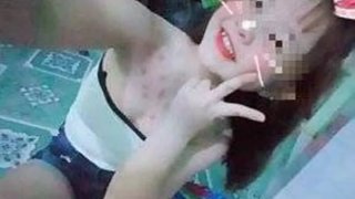 เด็กสาววัย12ปียิ้มร่า...โชว์รอยฟกช้ำตามลำตัว "เธอโดนอะไรมาใครรู้บอกหน่อยน่าสงสารมาก"