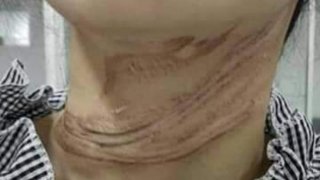 อีกกี่ศพ? อีกกี่ราย? ถึงจะแก้ไขบ้าง? สาวขี่จยย.มาดีๆ เจอสายโทรศัพท์​รัดคอเฉียดขาด