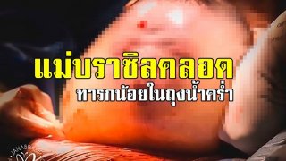 มหัศจรรย์มาก! คุณแม่บราซิลคลอดลูกน้อยออกมาทั้งถุงน้ำคร่ำ พบได้ยากหนึ่งใน 100,000