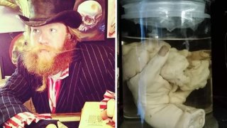 หลอนไปนะ!! พิพิธภัณฑ์ชิ้นส่วนมนุษย์ดอง ใครใจกล้าไปดูด้วยกันไหม?