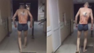 หนุ่มโดนมีดปักกลางหลัง แต่ยังย่องจะไปดูดบุหรี่ ได้ชิลๆ