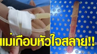 เตือนภัยใกล้ตัว หนูน้อยนั่งกินไอศกรีม พลัดตกเก้าอี้ไม้เสียบปาก เสี้ยววินาทีก็อันตราย