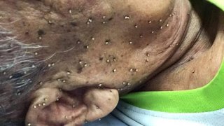 กู้ภัยผงะ พ่อเฒ่านอนร้องโอย ผึ้งรุมต่อย เหล็กในฝัง พรุนไปทั้งหน้า !