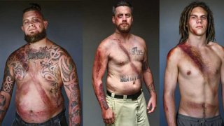 จากหนักเป็นเบา ..ด้วยความห่วงใย ภาพเตือนใจ.. บุคคลที่รอดตายจากรถชน เพื่อรณรงค์คาดเข็มขัดนิรภัย