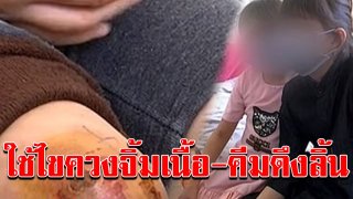 จับแม่เลี้ยงสาว ทำร้ายลูกติดสามี ใช้ไขควงจิ้มเนื้อ คีมดึงลิ้น