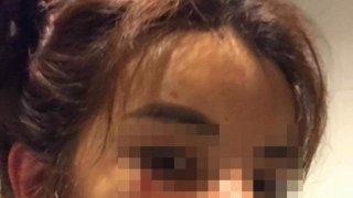 สาวถูกแฟนหนุ่มซ้อมเลือดอาบ หลังคบได้ 2 เดือน จมูกทะลุ-เลือดท่วม เหตุหึงเพราะเฟซบุ๊ก