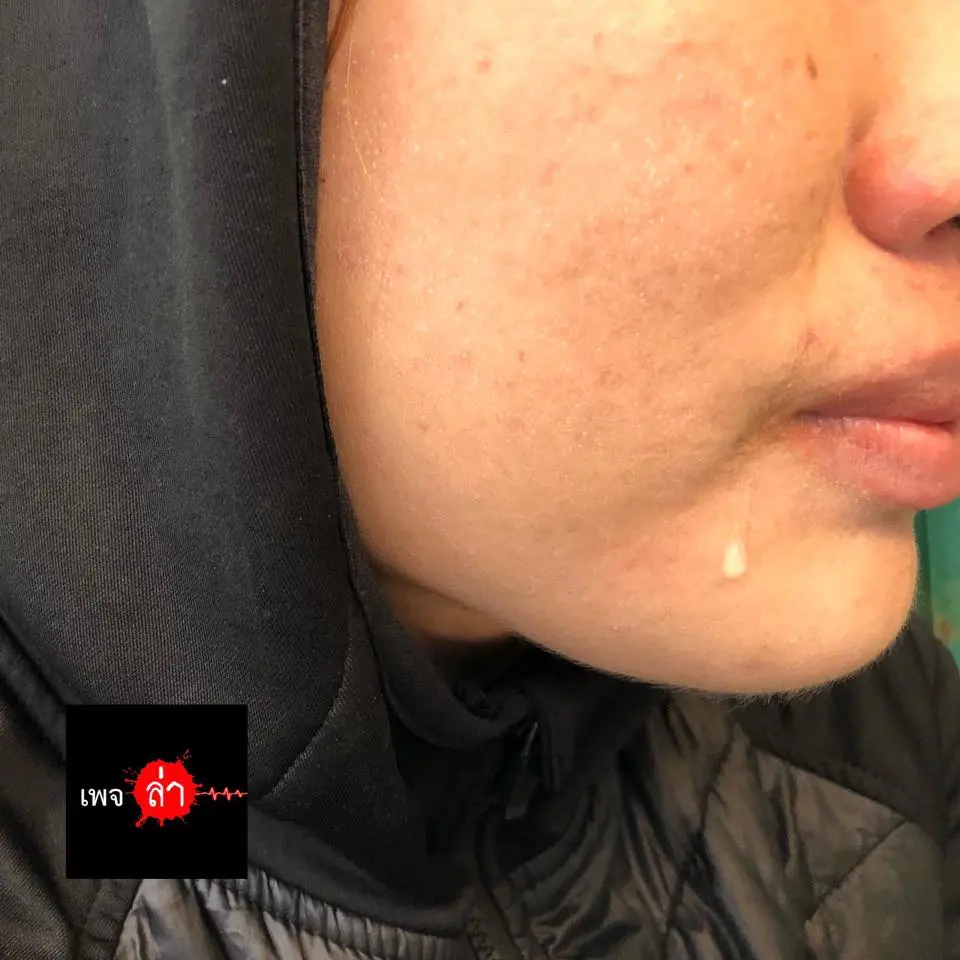 à¹à¸à¸ à¸²à¸à¸­à¸²à¸à¸à¸°à¸¡à¸µ à¸«à¸à¸¶à¹à¸à¸à¸à¸à¸¶à¹à¸à¹à¸ à¹à¸¥à¸°à¸ à¸²à¸à¸£à¸°à¸¢à¸°à¹à¸à¸¥à¹