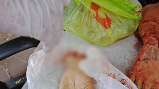 เกิดเหตุทะเลาะวิวาทชายข้อมือขาดศีรษะแตก ที่ปทุมธานีวันนี้