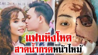 หนุ่มอดีตดับเพลิง หึงโหด สาดน้ำกรดใส่หน้าสาวคนรัก จนหน้าใบหน้าเสียโฉม