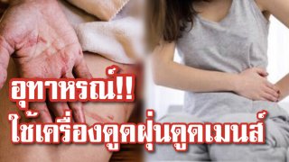 แพทย์เตือนห้ามเด็ดขาด!! สาวใช้เครื่องดูดฝุ่นดูด ดูดประจำเดือนจากช่องคลอด หวังให้หมดไวๆ