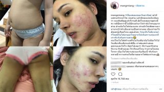 เธอมาไกลมาก!! เปิดชีวิต แมลงเมี่ยง พริตตี้เงินล้าน! ที่อดีต เคยเป็นสาวขี้เหร่ ขาหนีบดำ สิวเต็มหน้า