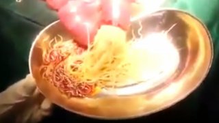 คลิปสยอง!! พยาธิไหลทะทักออกจากลำไส้เยอะมาก (เตือนภัยกินสุกๆ ดิบๆ)