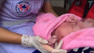 สุดแปลก..ทารก มี 24 นิ้ว คุณแม่วัย 23 ปี คลอดกระทันหันบนรถยนต์