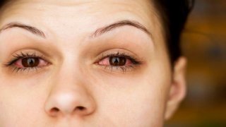 คันตา ตาแดง ควรระวัง เสี่ยงตาบอดได้