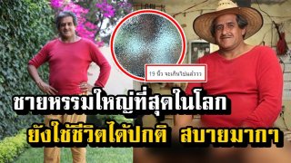 ทั่วโลกยอมรับ ชายที่มี น้องชายใหญ่ที่สุดในโลก 18.9 นิ้ว แต่ใช้ชีวิตได้ปกติ