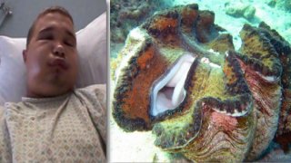 หอยหนีบจู๋ไม่ยอมปล่อย..นักดำน้ำหนุ่มวัย 22 ปี เห็นหอยมือเสืออ้าใต้ทะเล ควักจู๋แหย่จนต้องหามส่งโรงพยาบาล