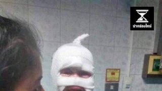 อุทาหรณ์ ให้เด็กเล็กเล่นกองไฟ เด็กเล็ก 2-3 ขวบเผลอหยิบกระป๋องสเปรย์ฉีดยุงโยนเข้ากองไฟ เกิดระเบิดสนั่น บาดเจ็บทั้งคู่