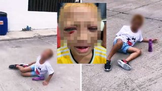 แม่ลั่น ลูกชาย 10 ขวบ ทำร้ายตัวเอง จนเป็นแผลเต็มตัว เผยหนีจากบ้าน ขโมยเงิน 5 หมื่นแจกเพื่อน