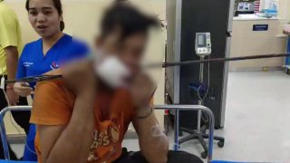 หวาดเสียว คนงานพม่าโดนลวดสลิงกระเด็นเข้าเสียบปาก ทะลุแก้มขวา